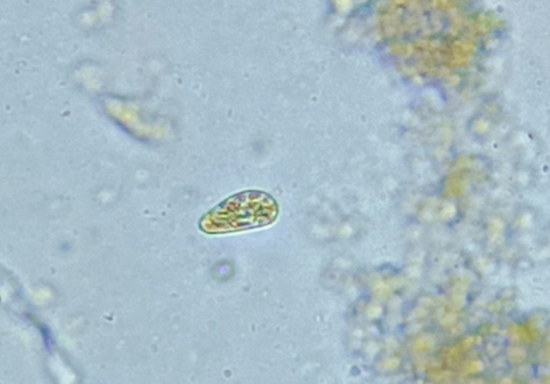 Bacilli o cos''altro?